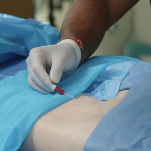 Интервенционное лечение боли